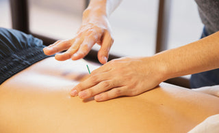 acupuncture vs dry needling