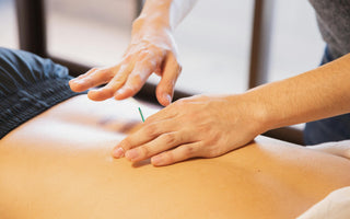 acupuncture vs dry needling